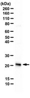 Anti-Recoverin Antibody | AB5585-I